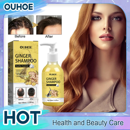 Hair Growth Shampoo Anti Hair Loss Itching Scalp Treatment Deep Cleaning Densing Moisturizing Oil Control Ginger Herbal Shampoo